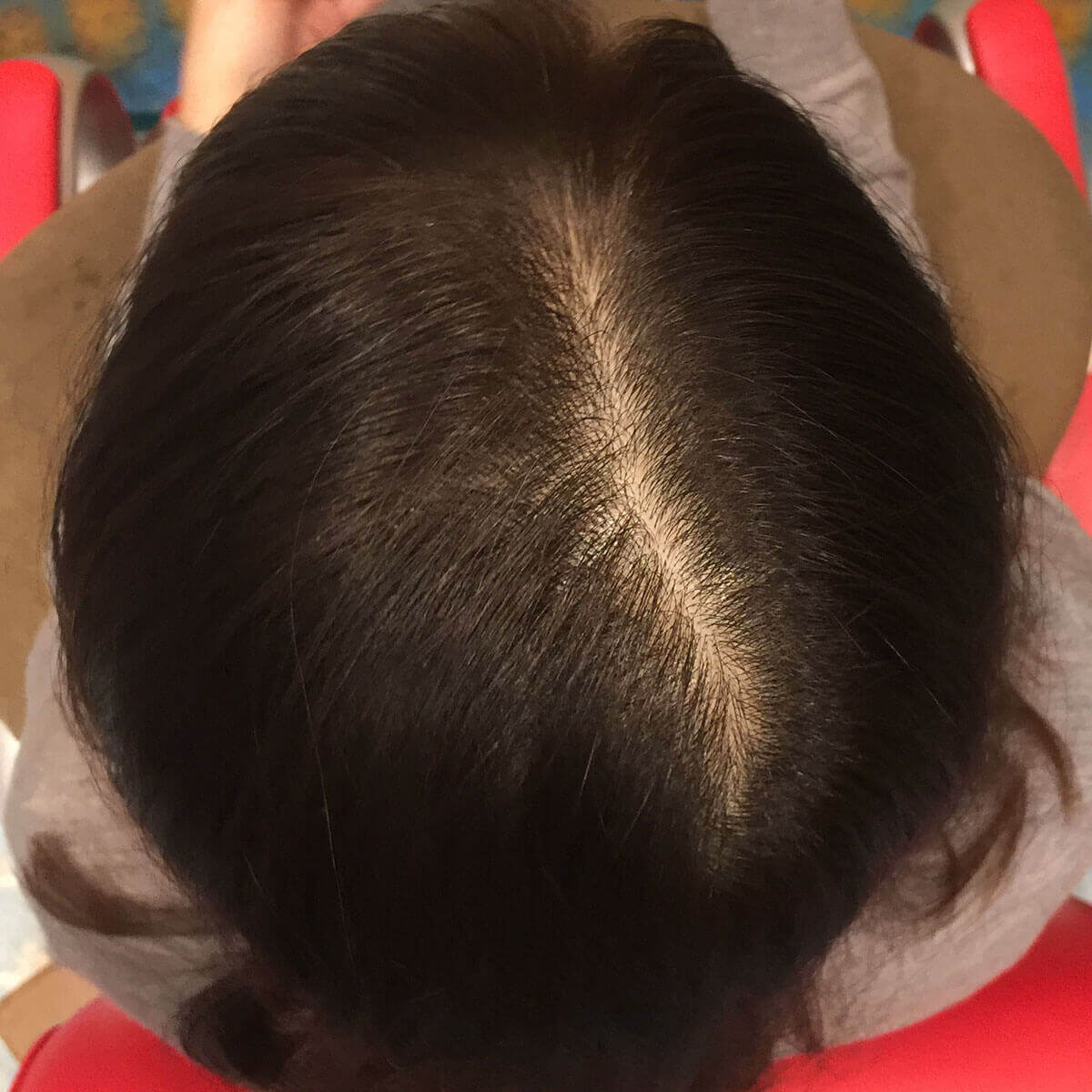 日本一馴染むエクステ専門店セクション Before & After 増毛エクステ② Before