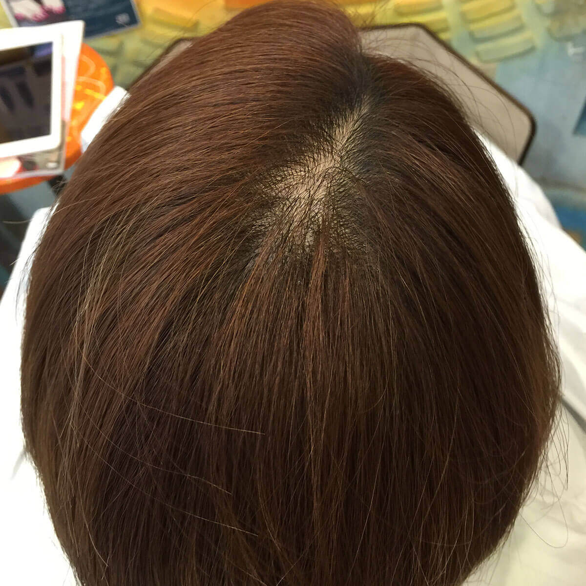 日本一馴染むエクステ専門店セクション Before & After 増毛エクステ③ Before